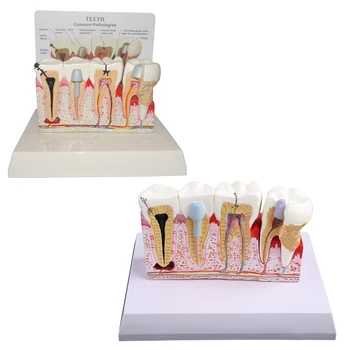 7x5.9x5.1inches Endodontinis Švietimo Modelį Studijų Mokyti Dantų Modelio Mokosi Mokymo Ekranas Dantų Ėduonis